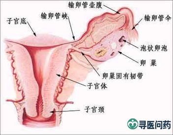 输卵管造影