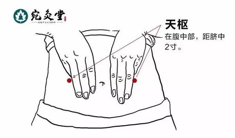 艾灸知识:天枢穴,疏调肠腑,理气消滞,通便