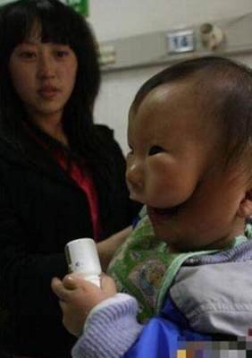 中国奇形婴儿 360图片