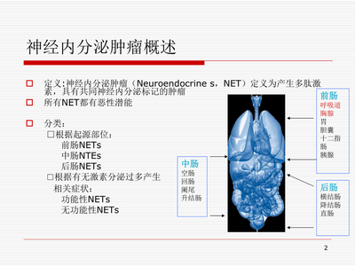 神经内分泌肿瘤
