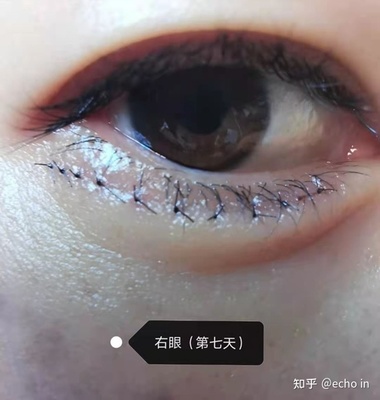 化妆眼袋怎么遮盖
