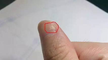 指甲破裂是怎么回事