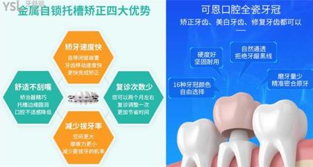 医院牙齿美白需要多少