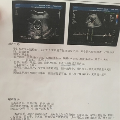 胎儿畸形能检查出来吗