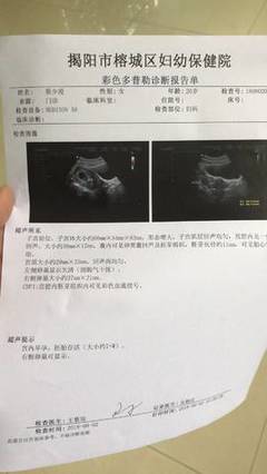 怀孕两天会恶心吗