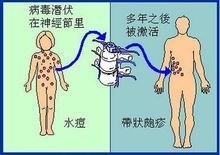 皮肤病生蛇怎么治疗