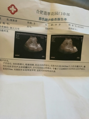 怀孕当月有什么症状