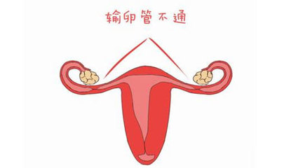有妇科炎症可以怀孕吗