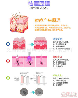 蓝光祛痘原理