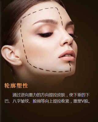 埋线提升脸