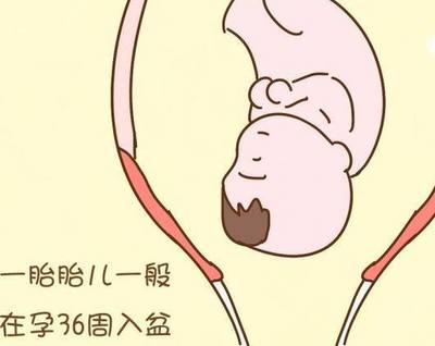 胎儿一直不入盆怎么办