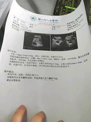 孕9周胎儿