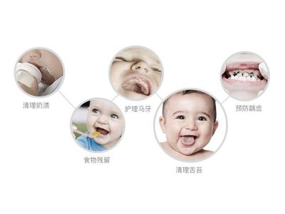 3岁宝宝牙齿