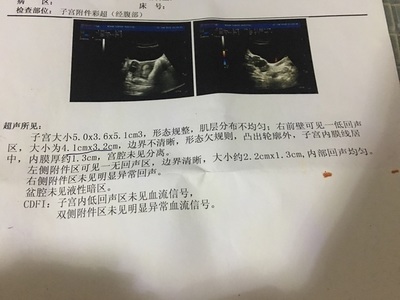 怎么样怀孕几率大