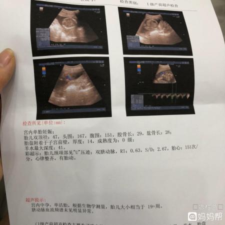 怀孕四个半月胎儿有多大