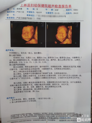 32周胎儿