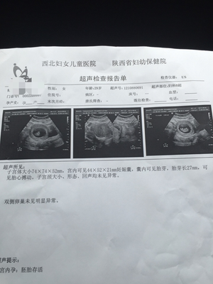 B超检查提前多少时间喝水