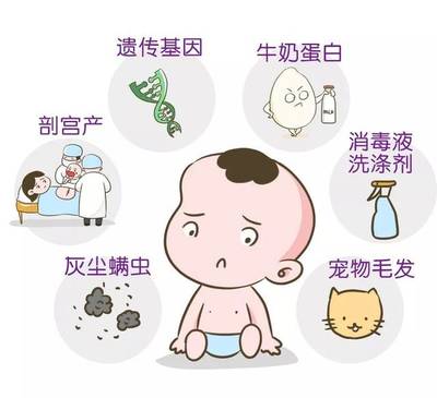 宝宝   过敏
