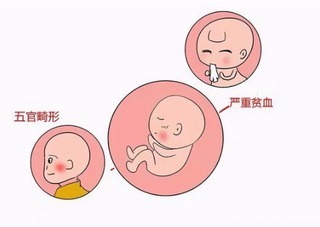 新生儿拉肚子什么原因引起的