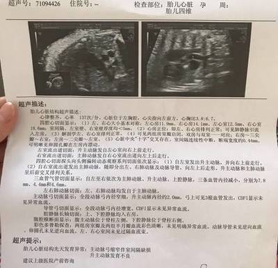 33周胎儿发育情况