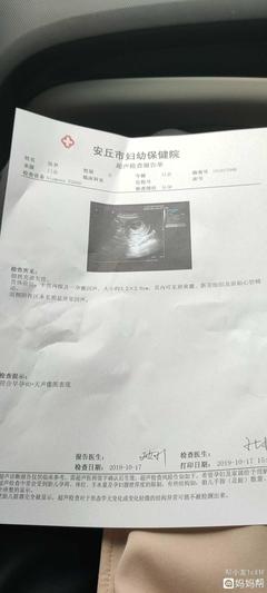 怀孕50天做什么检查