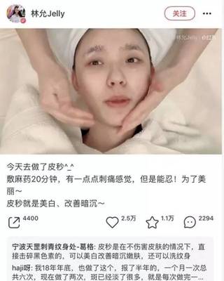 皮秒祛斑好不好