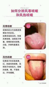 宝宝咳嗽推拿管用吗
