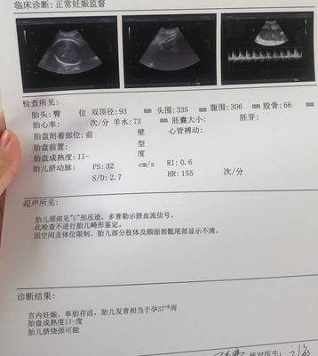 早孕多少周可以做彩超检查