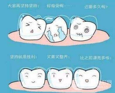 牙齿矫正好处
