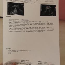 怀孕可以吃蟹钳吗