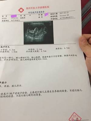 怀孕后要做什么检查