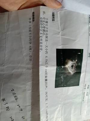 怀孕八周是几个月
