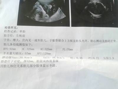 宝宝多重正常