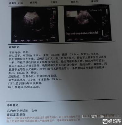 37周肱骨长多少