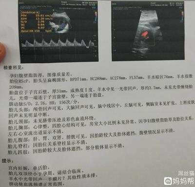 孕妇32周做什么检查