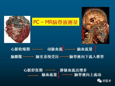 变频器op2是什么故障