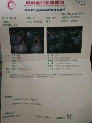 甲状腺偏小是怎么回事