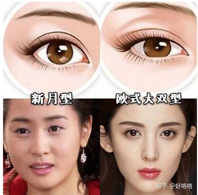 割了双眼皮后特后悔