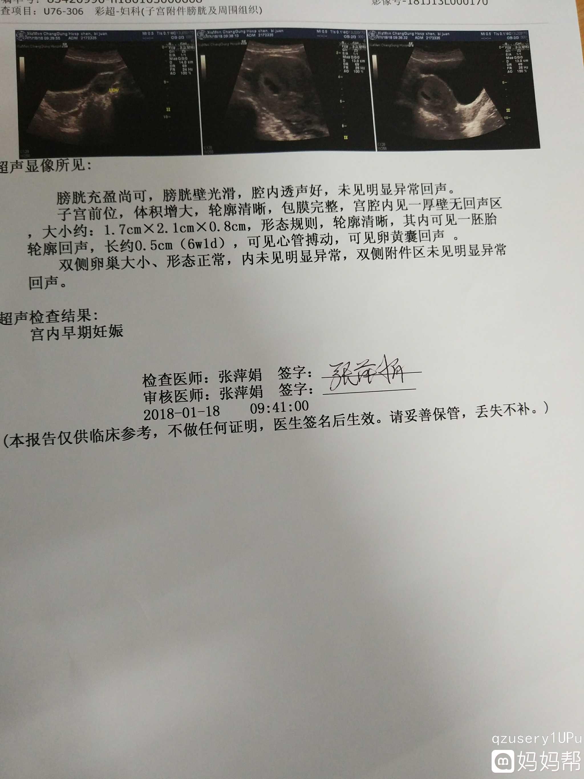 怀孕做彩超需要空腹吗