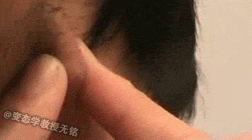 后脑勺都是痘痘