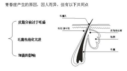 挑痘痘后能洗脸吗