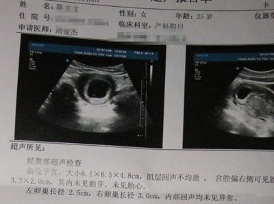 卵泡一个月有几个