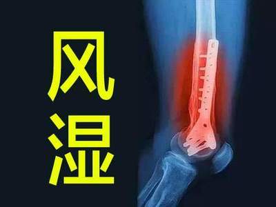 关节炎怎么治疗