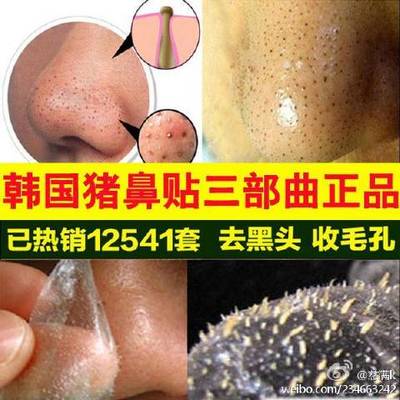 猪鼻贴会不会把毛孔大