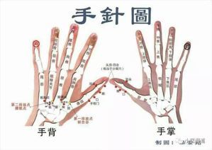 无名指痛是怎么回事