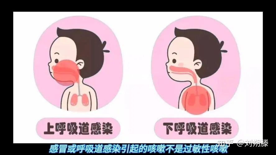 咳嗽怎么排痰