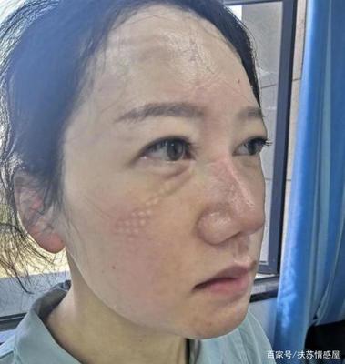 鼻子发酸是怎么回事