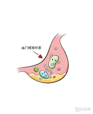 宝宝幽门螺旋杆菌