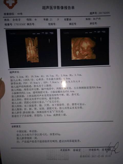 胎儿肾盂分离是什么意思