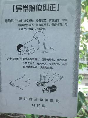 怀孕臀位怎么办